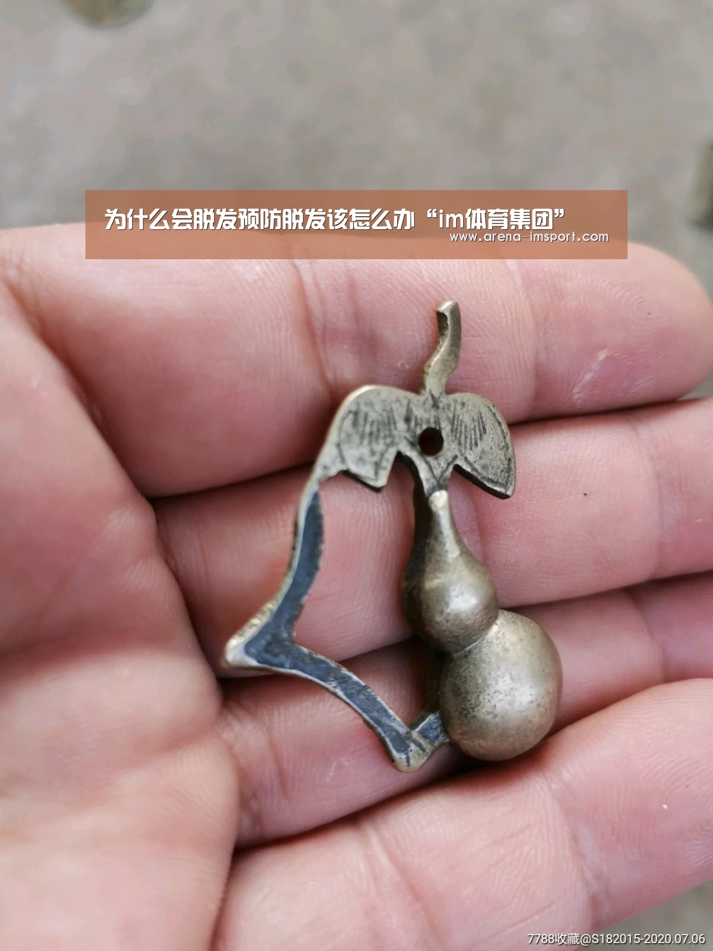 为什么会脱发预防脱发该怎么办“im体育集团”(图2) im体育官网